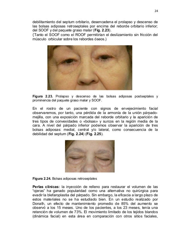 anatomia quirurgica facial Tiny teen mania